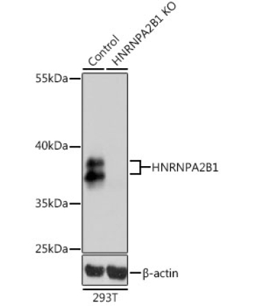 HNRNPA2B1 Rabbit Polyclonal Antibody [KO Validated]