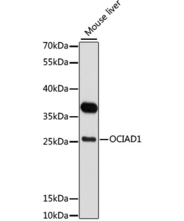 OCIAD1 Rabbit Polyclonal Antibody