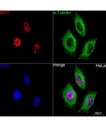 MITF Rabbit Monoclonal Antibody