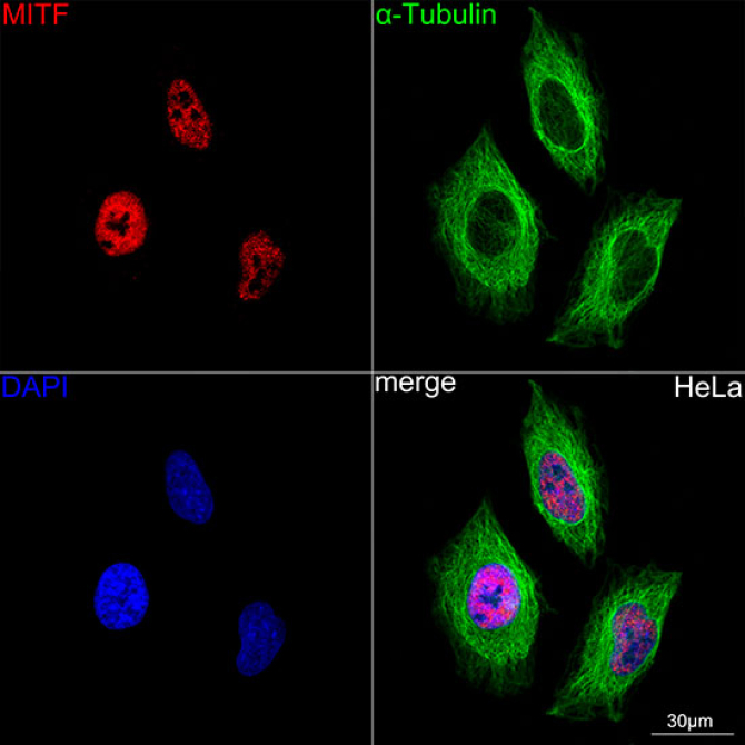 MITF Rabbit Monoclonal Antibody