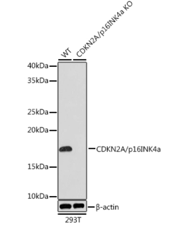 CDKN2A/p16INK4a Rabbit Monoclonal Antibody [KO Validated]