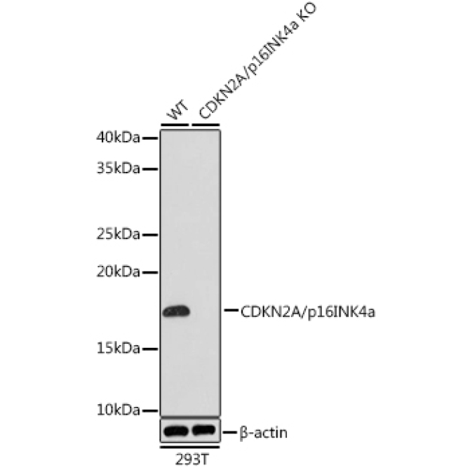CDKN2A/p16INK4a Rabbit Monoclonal Antibody [KO Validated]