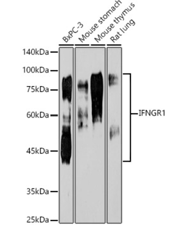 IFNGR1 Rabbit Monoclonal Antibody [KO Validated]