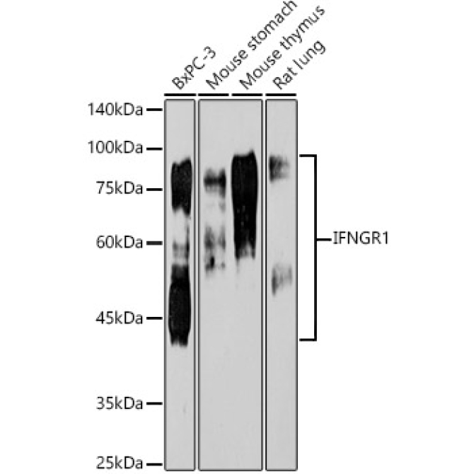 IFNGR1 Rabbit Monoclonal Antibody [KO Validated]