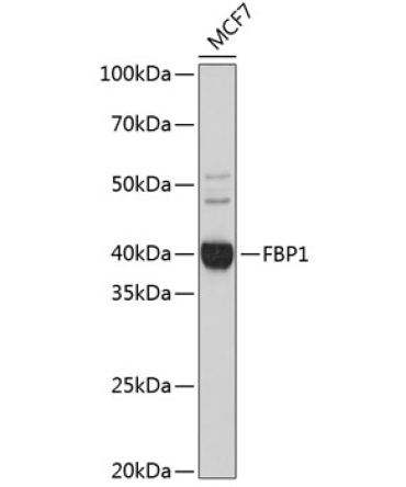 FBP1 Rabbit Monoclonal Antibody
