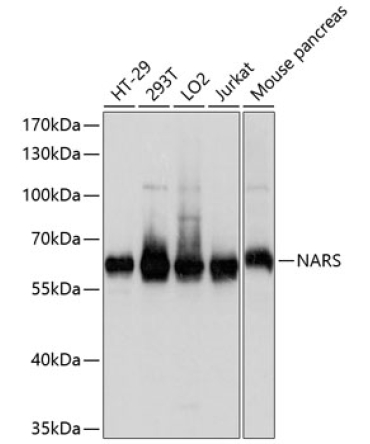 NARS Rabbit Polyclonal Antibody