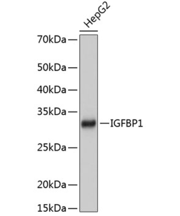 IGFBP1 Rabbit Monoclonal Antibody