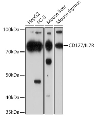 CD127/IL7R Rabbit Monoclonal Antibody