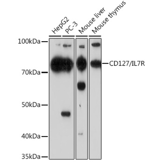 CD127/IL7R Rabbit Monoclonal Antibody