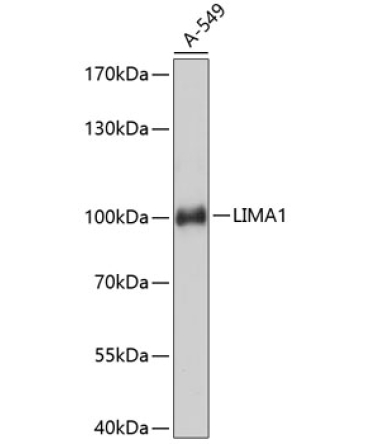 LIMA1 Rabbit Polyclonal Antibody