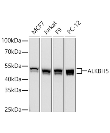ALKBH5 Rabbit Polyclonal Antibody