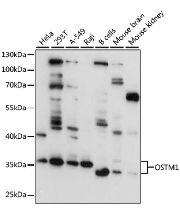 OSTM1 Rabbit Polyclonal Antibody