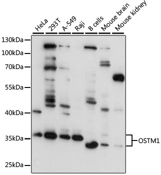 OSTM1 Rabbit Polyclonal Antibody