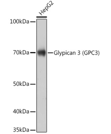 Glypican 3 (GPC3) Rabbit Monoclonal Antibody