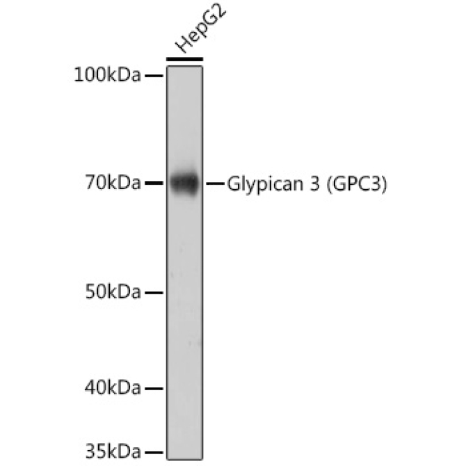 Glypican 3 (GPC3) Rabbit Monoclonal Antibody