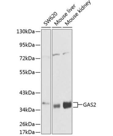 GAS2 Rabbit Polyclonal Antibody