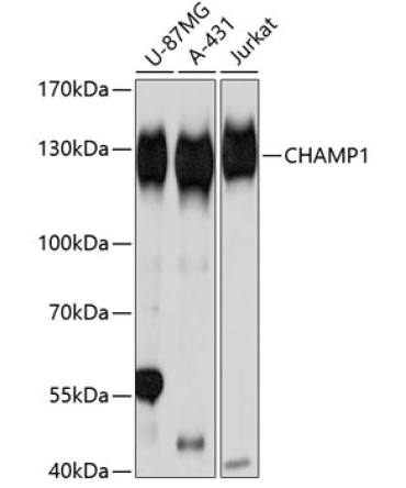 CHAMP1 Rabbit Polyclonal Antibody