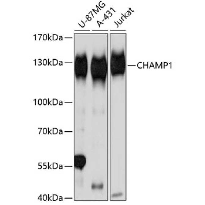 CHAMP1 Rabbit Polyclonal Antibody
