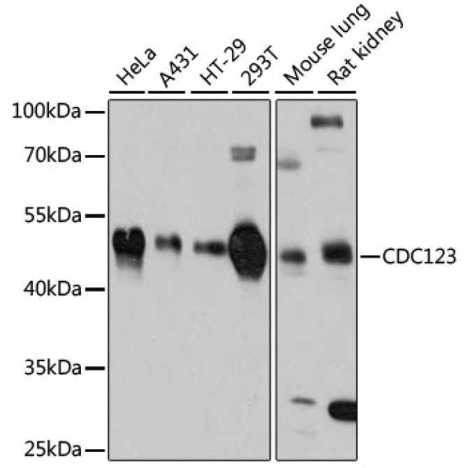 CDC123 Rabbit Polyclonal Antibody