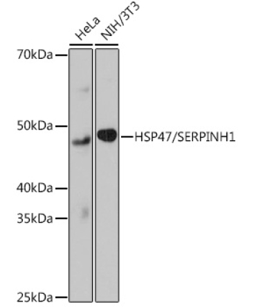 HSP47/SERPINH1 Rabbit Monoclonal Antibody