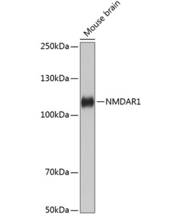 NMDAR1 Rabbit Monoclonal Antibody