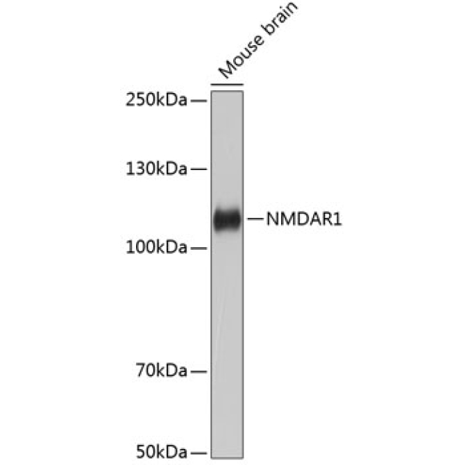 NMDAR1 Rabbit Monoclonal Antibody