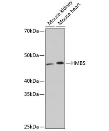 HMBS Rabbit Monoclonal Antibody