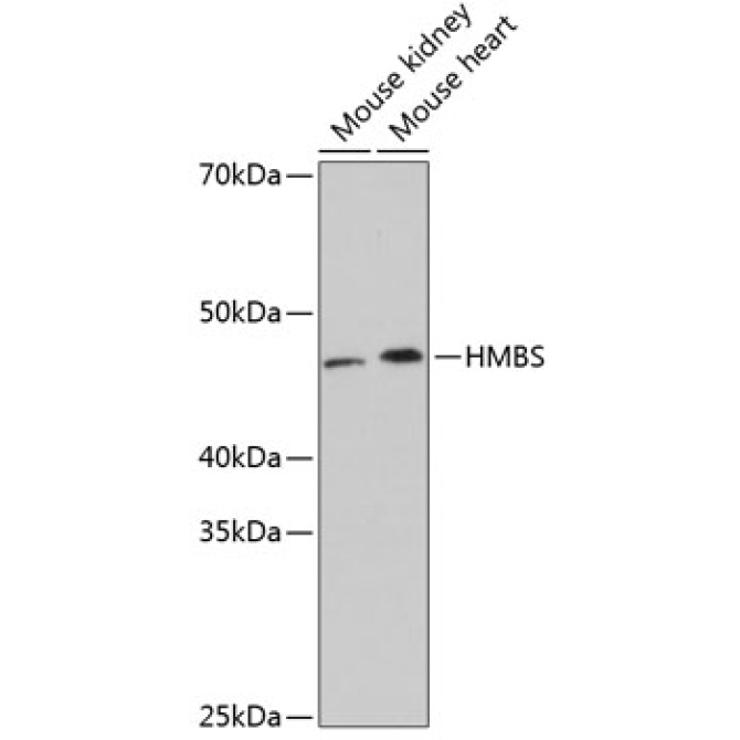 HMBS Rabbit Monoclonal Antibody
