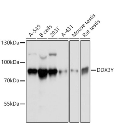 DDX3Y Rabbit Polyclonal Antibody