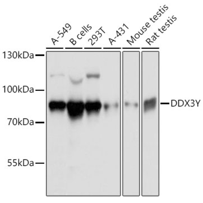DDX3Y Rabbit Polyclonal Antibody