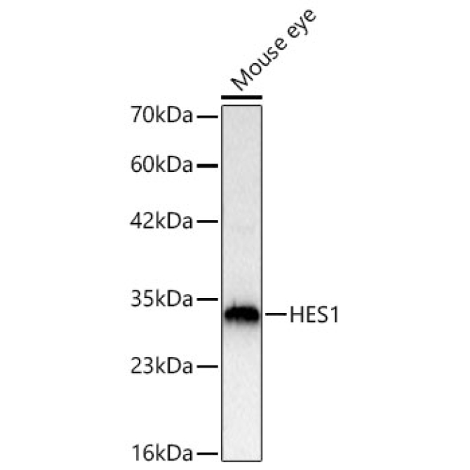 HES1 Rabbit Polyclonal Antibody