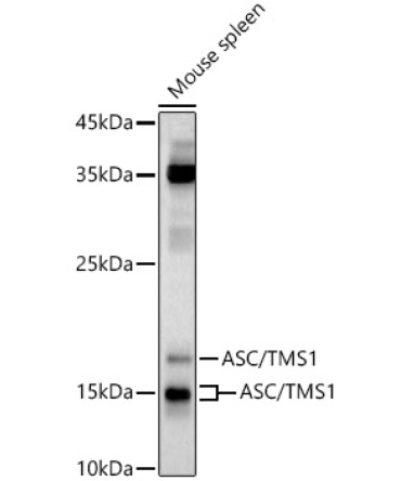 ASC/TMS1 Rabbit Polyclonal Antibody