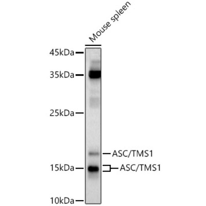 ASC/TMS1 Rabbit Polyclonal Antibody