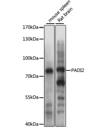 PADI2 Rabbit Polyclonal Antibody