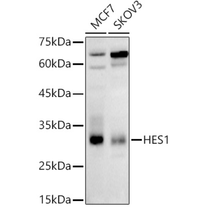 HES1 Rabbit Polyclonal Antibody