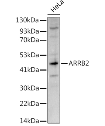 ARRB2 Rabbit Polyclonal Antibody