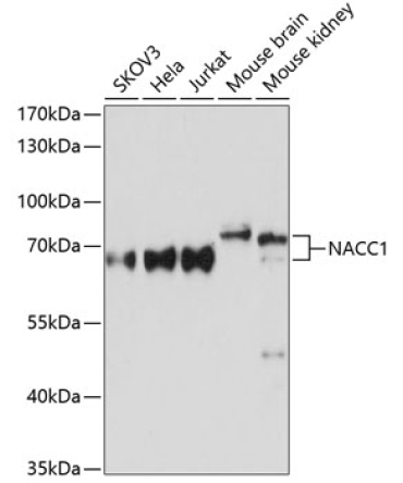 NACC1 Rabbit Polyclonal Antibody