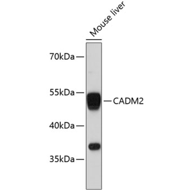 CADM2 Rabbit Polyclonal Antibody