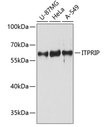 ITPRIP Rabbit Polyclonal Antibody
