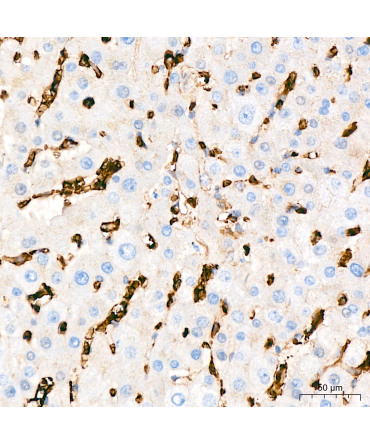 GLUT1/SLC2A1 Rabbit Monoclonal Antibody