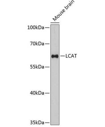 LCAT Rabbit Polyclonal Antibody