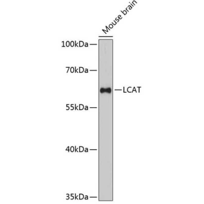 LCAT Rabbit Polyclonal Antibody