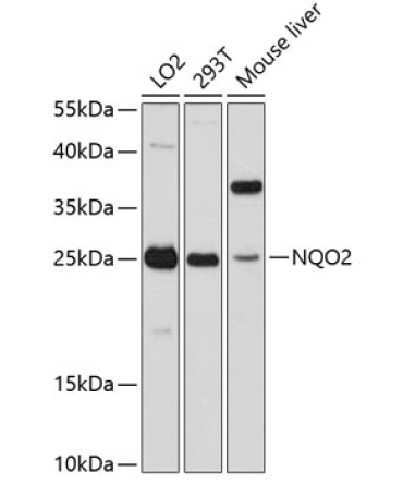 NQO2 Rabbit Polyclonal Antibody