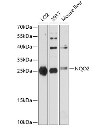 NQO2 Rabbit Polyclonal Antibody