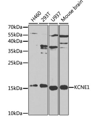 KCNE1 Rabbit Polyclonal Antibody