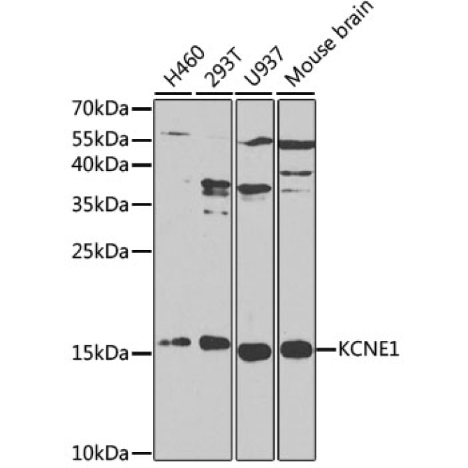 KCNE1 Rabbit Polyclonal Antibody