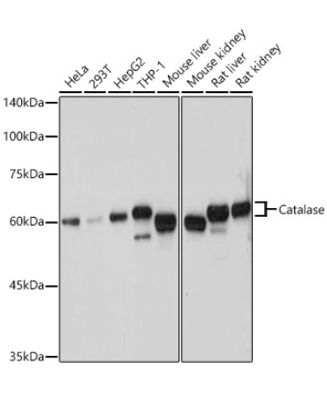Catalase Rabbit Polyclonal Antibody