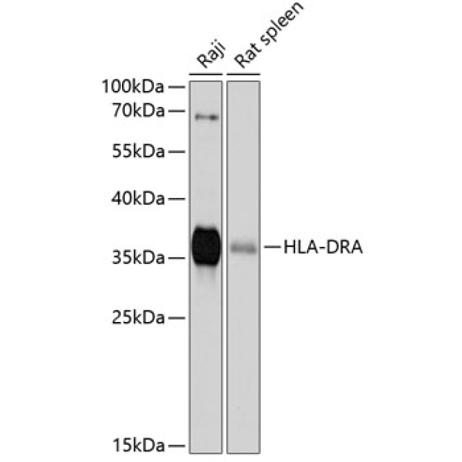 HLA-DRA Rabbit Polyclonal Antibody