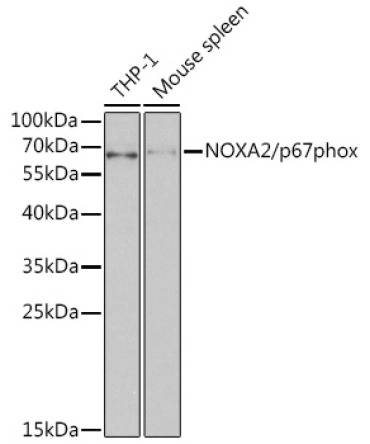 NOXA2/p67phox Rabbit Polyclonal Antibody