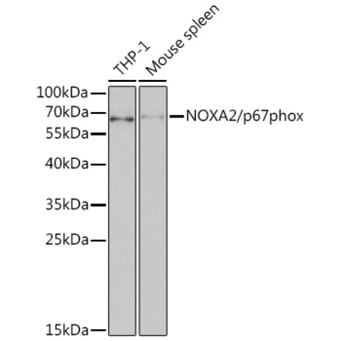 NOXA2/p67phox Rabbit Polyclonal Antibody